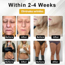 BQYOOM™ ApisPDRN DermoTense Creme Lifting