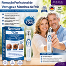 NEWCANET® - Remoção de machas e verrugas