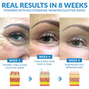 Cremes antienvelhecimento para os olhos com NMN e ácido hialurônico para hidratação imediata - Uma aparência descansada!