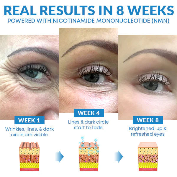 Cremes antienvelhecimento para os olhos com NMN e ácido hialurônico para hidratação imediata - Uma aparência descansada!