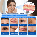 PDRN BELLE® Tratamento Antirrugas com Botox e PDRN – Creme Lifting e Firmador