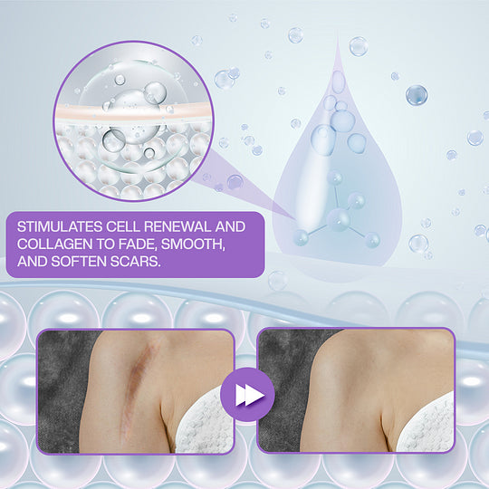 RevivaDerma Gel para Cicatrizes Faciais e Corporais