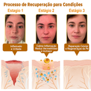 Creme BeeRx™ – Pele Renovada Naturalmente