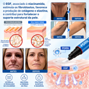 PDRN BELLE® Tratamento Antirrugas com Botox e PDRN – Creme Lifting e Firmador