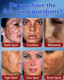 Bloobeac® Creme de Beleza Removedor de Manchas