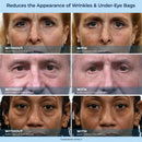 LBMLBM™ Sérum de Redução Rápida de Rugas