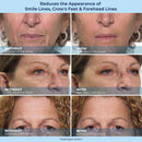 LBMLBM™ Sérum de Redução Rápida de Rugas